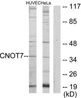 CNOT7 Antibody - Western blot analysis of lysates from HeLa and HUVEC cells, using CNOT7 Antibody. The lane on the right is blocked with the synthesized peptide.