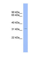 CNOT7 Antibody - CNOT7 antibody Western blot of Placenta lysate. This image was taken for the unconjugated form of this product. Other forms have not been tested.
