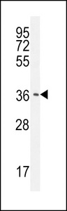 CNOT7 Antibody - CAF-1 Antibody western blot of HepG2 cell line lysates (35 ug/lane). The CAF-1 antibody detected the CAF-1 protein (arrow).