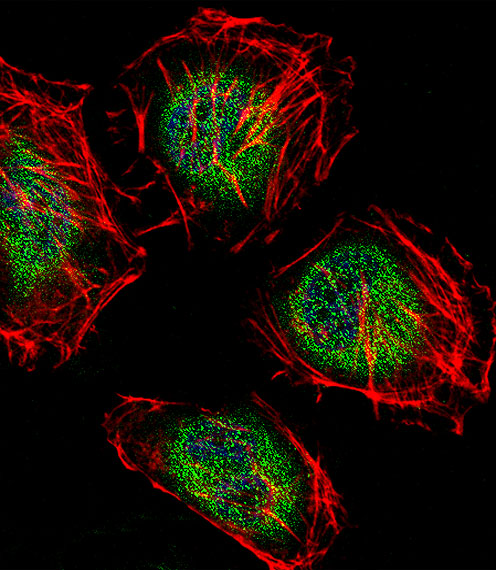 CNOT7 Antibody - Fluorescent confocal image of HeLa cell stained with CAF-1 Antibody. HeLa cells were fixed with 4% PFA (20 min), permeabilized with Triton X-100 (0.1%, 10 min), then incubated with CAF-1 primary antibody (1:25, 1 h at 37°C). For secondary antibody, Alexa Fluor 488 conjugated donkey anti-rabbit antibody (green) was used (1:400, 50 min at 37°C). Cytoplasmic actin was counterstained with Alexa Fluor 555 (red) conjugated Phalloidin (7units/ml, 1 h at 37°C). Nuclei were counterstained with DAPI (blue) (10 ug/ml, 10 min). CAF-1 immunoreactivity is localized to Cytoplasm and Nucleus significantly.