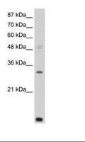 CNOT7 Antibody - HepG2 Cell Lysate.  This image was taken for the unconjugated form of this product. Other forms have not been tested.