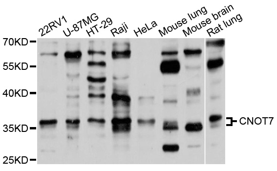 CNOT7 Antibody - Western blot analysis of extracts of various cell lines.