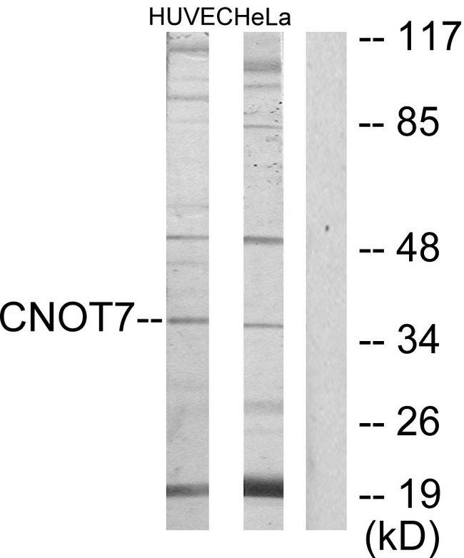 CNOT7 Antibody - Western blot analysis of extracts from HUVEC cells and HeLa cells, using CNOT7 antibody.