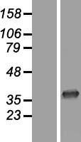 CNOT7 Protein - Western validation with an anti-DDK antibody * L: Control HEK293 lysate R: Over-expression lysate