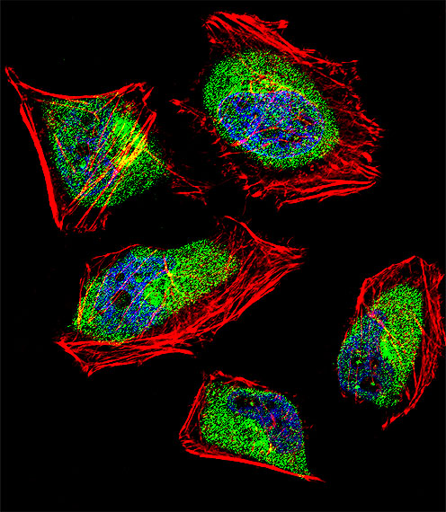 CNOT8 Antibody - Fluorescent confocal image of HeLa cell stained with CNOT8 Antibody. HeLa cells were fixed with 4% PFA (20 min), permeabilized with Triton X-100 (0.1%, 10 min), then incubated with CNOT8 primary antibody (1:25, 1 h at 37°C). For secondary antibody, Alexa Fluor 488 conjugated donkey anti-rabbit antibody (green) was used (1:400, 50 min at 37°C). Cytoplasmic actin was counterstained with Alexa Fluor 555 (red) conjugated Phalloidin (7units/ml, 1 h at 37°C). Nuclei were counterstained with DAPI (blue) (10 ug/ml, 10 min). CNOT8 immunoreactivity is localized to Cytoplasm significantly and Nucleus weakly.