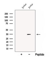 CNOT8 Antibody - Western blot analysis of extracts of Jurkat cells using CNOT8 antibody. The lane on the left was treated with blocking peptide.
