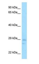 CNOT8 Antibody - HCAF1 / CNOT8 antibody Western Blot of Mouse Testis.  This image was taken for the unconjugated form of this product. Other forms have not been tested.