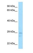 CNOT8 Antibody - HCAF1 / CNOT8 antibody Western Blot of Mouse Testis.  This image was taken for the unconjugated form of this product. Other forms have not been tested.