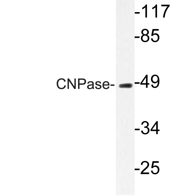 CNPase Antibody - Western blot analysis of lysate from HUVEC cells, using CNPase antibody.