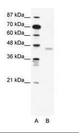 CNPase Antibody - A: Marker, B: Jurkat Cell Lysate.  This image was taken for the unconjugated form of this product. Other forms have not been tested.