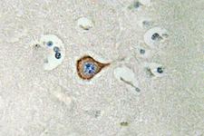 CNPase Antibody - IHC of CNPase (A108) pAb in paraffin-embedded human brain tissue.