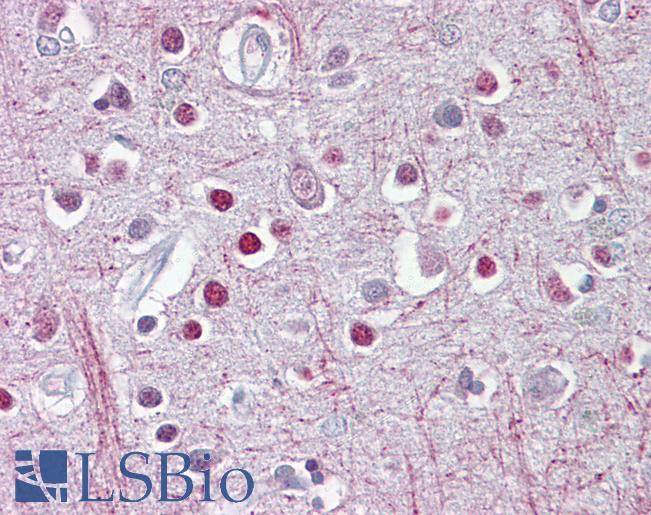 CNPase Antibody - Anti-CNP antibody IHC of human brain, cortex. Immunohistochemistry of formalin-fixed, paraffin-embedded tissue after heat-induced antigen retrieval. Antibody concentration 5 ug/ml.  This image was taken for the unconjugated form of this product. Other forms have not been tested.