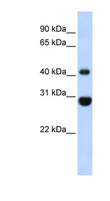 CNPase Antibody - CNP antibody Western blot of Fetal Muscle lysate. This image was taken for the unconjugated form of this product. Other forms have not been tested.