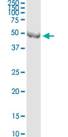 CNPase Antibody - CNP monoclonal antibody (M01), clone 2E8. Western Blot analysis of CNP expression in human colon.