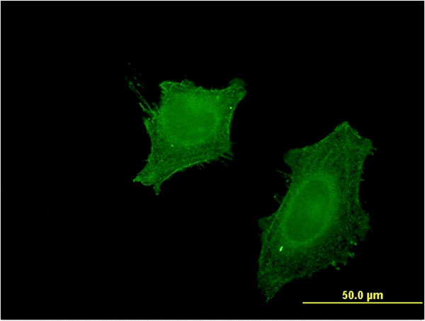 CNPase Antibody - Immunofluorescence of monoclonal antibody to CNP on HeLa cell . [antibody concentration 10 ug/ml]
