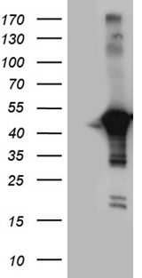 CNPase Antibody - HEK293T cells were transfected with the pCMV6-ENTRY control. (Left lane) or pCMV6-ENTRY CNP. (Right lane) cDNA for 48 hrs and lysed. Equivalent amounts of cell lysates. (5 ug per lane) were separated by SDS-PAGE and immunoblotted with anti-CNP. (1:2000)
