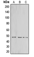 CNPase Antibody - Western blot analysis of CNPase expression in HeLa (A); mouse brain (B); rat brain (C) whole cell lysates.