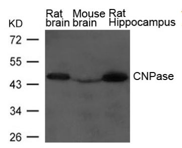 CNPase Antibody - Western blot of extract from Rat brain, Mouse brain and Rat hippocampus Tissue using CNPase Antibody