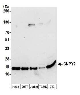 Cnpy2 / TMEM4 Antibody - Detection of human and mouse CNPY2 by western blot. Samples: Whole cell lysate (50 µg) from HeLa, HEK293T, Jurkat, mouse TCMK-1, and mouse NIH 3T3 cells prepared using NETN lysis buffer. Antibody: Affinity purified rabbit anti-CNPY2 antibody used for WB at 1:1000. Detection: Chemiluminescence with an exposure time of 30 seconds.