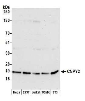 Cnpy2 / TMEM4 Antibody - Detection of human and mouse CNPY2 by western blot. Samples: Whole cell lysate (15 µg) from HeLa, HEK293T, Jurkat, mouse TCMK-1, and mouse NIH 3T3 cells prepared using NETN lysis buffer. Antibody: Affinity purified rabbit anti-CNPY2 antibody used for WB at 1:1000. Detection: Chemiluminescence with an exposure time of 30 seconds.