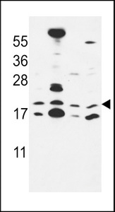 Cnpy2 / TMEM4 Antibody - CNPY2 Antibody western blot of MCF-7,NCI-H460,HepG2,HeLa cell line lysates (35 ug/lane). The CNPY2 antibody detected the CNPY2 protein (arrow).