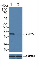 Cnpy2 / TMEM4 Antibody - Knockout Varification: Lane 1: Wild-type MCF7 cell lysate; Lane 2: CNPY2 knockout MCF7 cell lysate; Predicted MW: 21,9kd Observed MW: 20kd Primary Ab: 1µg/ml Rabbit Anti-Human CNPY2 Antibody Second Ab: 0.2µg/mL HRP-Linked Caprine Anti-Rabbit IgG Polyclonal Antibody