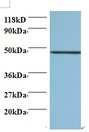 Cnpy2 / TMEM4 Antibody - Western blot of Protein canopy homolog 2 antibody at 2 ug/ml + 293T whole cell lysate. Secondary: Goat polyclonal to Rabbit IgG at 1:15000 dilution. Predicted band size: 20 kDa. Observed band size: 47 kDa.  This image was taken for the unconjugated form of this product. Other forms have not been tested.