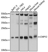 Cnpy2 / TMEM4 Antibody - Western blot analysis of extracts of various cell lines, using CNPY2 antibody at 1:1000 dilution. The secondary antibody used was an HRP Goat Anti-Rabbit IgG (H+L) at 1:10000 dilution. Lysates were loaded 25ug per lane and 3% nonfat dry milk in TBST was used for blocking. An ECL Kit was used for detection and the exposure time was 5s.
