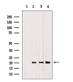 Cnpy2 / TMEM4 Antibody - Western blot analysis of extracts of 293, B16F10, mouse myeloma using CNPY2, MSAP antibody. Lane 1 was treated with the blocking peptide.