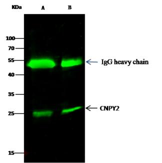 Cnpy2 / TMEM4 Antibody - CNPY2 was immunoprecipitated using: Lane A: 0.5 mg MCF-7 Whole Cell Lysate. Lane B: 0.5 mg Hela Whole Cell Lysate. 2 uL anti-CNPY2 rabbit polyclonal antibody and 15 ul of 50% Protein G agarose. Primary antibody: Anti-CNPY2 rabbit polyclonal antibody, at 1:200 dilution. Secondary antibody: Dylight 800-labeled antibody to rabbit IgG (H+L), at 1:5000 dilution. Developed using the odssey technique. Performed under reducing conditions. Predicted band size: 21 kDa.