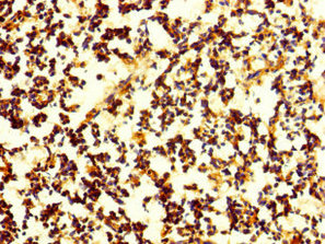 CNPY4 Antibody - Immunohistochemistry of paraffin-embedded human appendix tissue using CNPY4 Antibody at dilution of 1:100