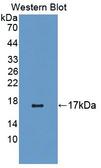 CNR1 / CB1 Antibody - Western blot of CNR1 / CB1 antibody.