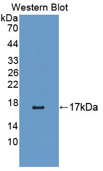 CNR1 / CB1 Antibody - Western blot of CNR1 / CB1 antibody.