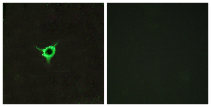 CNR1 / CB1 Antibody - Immunofluorescence analysis of LOVO cells, using CNR1 Antibody. The picture on the right is blocked with the synthesized peptide.