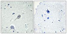 CNR1 / CB1 Antibody - Immunohistochemistry analysis of paraffin-embedded human brain tissue, using CNR1 Antibody. The picture on the right is blocked with the synthesized peptide.