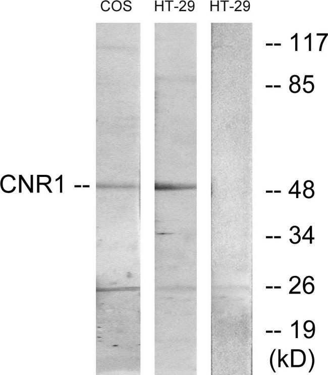 CNR1 / CB1 Antibody - Western blot analysis of lysates from HT-29 and COS7 cells, using CNR1 Antibody. The lane on the right is blocked with the synthesized peptide.