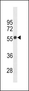 CNR1 / CB1 Antibody - CB1 Antibody western blot of 293 cell line lysates (35 ug/lane). The CB1 antibody detected the CB1 protein (arrow).