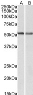 CNR1 / CB1 Antibody - Goat Anti-CB1 (isoform a) Antibody (0.3µg/ml) staining of A549 (A) and NIH3T3 (B) lysates (35µg protein in RIPA buffer). Primary incubation was 1 hour. Detected by chemiluminescencence.