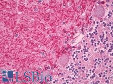 CNR1 / CB1 Antibody - Human, Brain Cerebellum: Formalin-Fixed Paraffin-Embedded (FFPE).  This image was taken for the unconjugated form of this product. Other forms have not been tested.