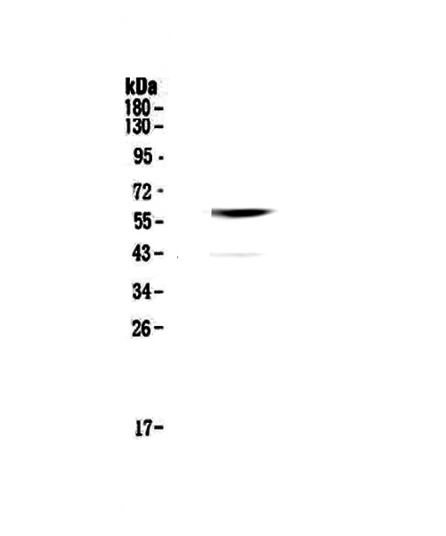 CNR1 / CB1 Antibody - Western blot - Anti-Cannabinoid Receptor I antibody