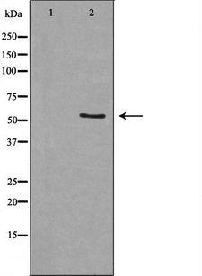 CNR1 / CB1 Antibody - Western blot analysis of extracts of COS-7 cells using CNR1 antibody. The lane on the left is treated with the antigen-specific peptide.