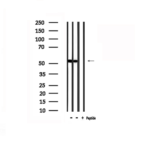 CNR1 / CB1 Antibody - Western blot analysis of extracts of HepG2 and mouse lung using CNR1 antibody.