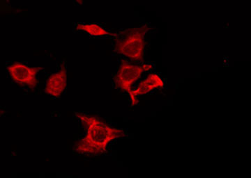 CNR1 / CB1 Antibody - Staining 293T cells by IF/ICC. The samples were fixed with PFA and permeabilized in 0.1% Triton X-100, then blocked in 10% serum for 45 min at 25°C. The primary antibody was diluted at 1:200 and incubated with the sample for 1 hour at 37°C. An Alexa Fluor 594 conjugated goat anti-rabbit IgG (H+L) Ab, diluted at 1/600, was used as the secondary antibody.