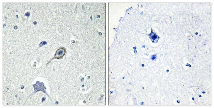 CNR1 / CB1 Antibody - Peptide - + Immunohistochemistry analysis of paraffin-embedded human brain tissue using CNR1 antibody.