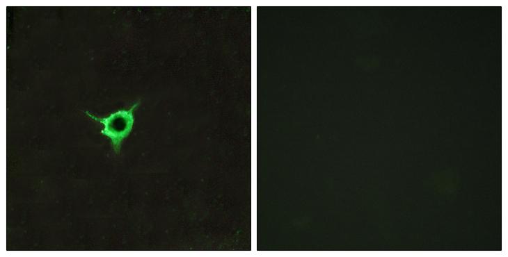 CNR1 / CB1 Antibody - Peptide - + Immunofluorescence analysis of LOVO cells, using CNR1 antibody.