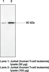 CNR2 / CB2 Antibody - Western blot of CNR2 / CB2 antibody.