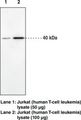CNR2 / CB2 Antibody - Western blot of CNR2 / CB2 antibody.