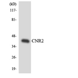 CNR2 / CB2 Antibody - Western blot analysis of the lysates from HT-29 cells using CNR2 antibody.
