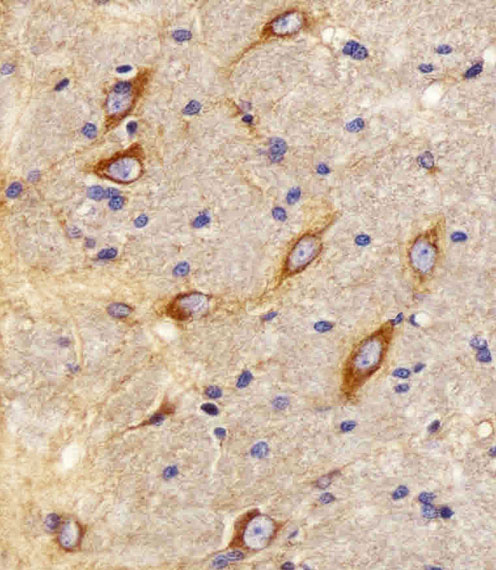 CNR2 / CB2 Antibody - Immunohistochemical of paraffin-embedded R. brain section using CB2 Antibody. Antibody was diluted at 1:25 dilution. A peroxidase-conjugated goat anti-rabbit IgG at 1:400 dilution was used as the secondary antibody, followed by DAB staining.