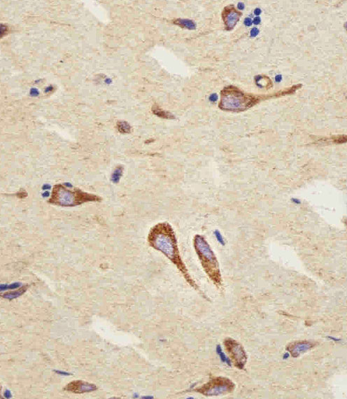 CNR2 / CB2 Antibody - Immunohistochemical of paraffin-embedded H. brain section using CB2 Antibody. Antibody was diluted at 1:25 dilution. A peroxidase-conjugated goat anti-rabbit IgG at 1:400 dilution was used as the secondary antibody, followed by DAB staining.